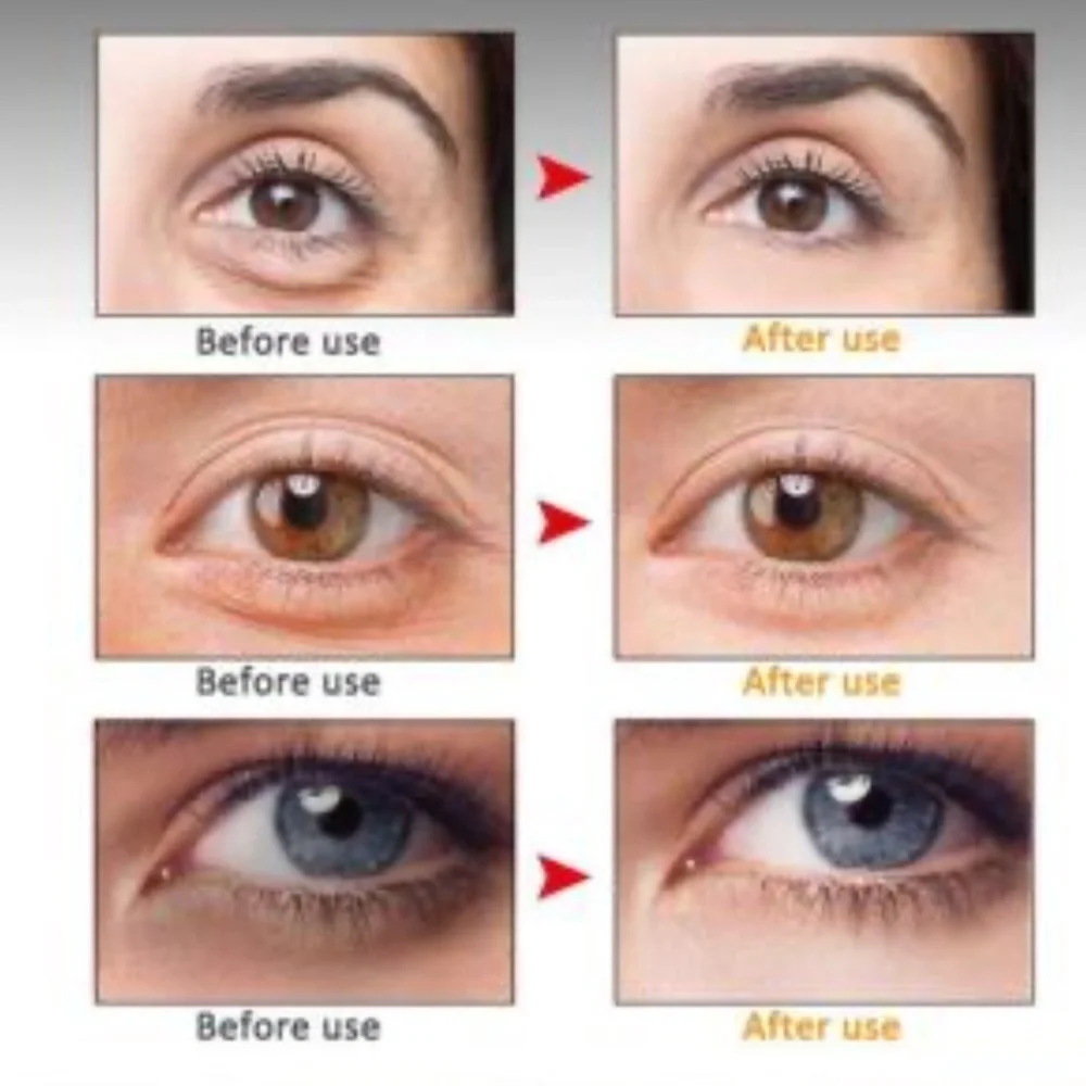Peptide Nourishing Anti- Wrinkle Eye Serum